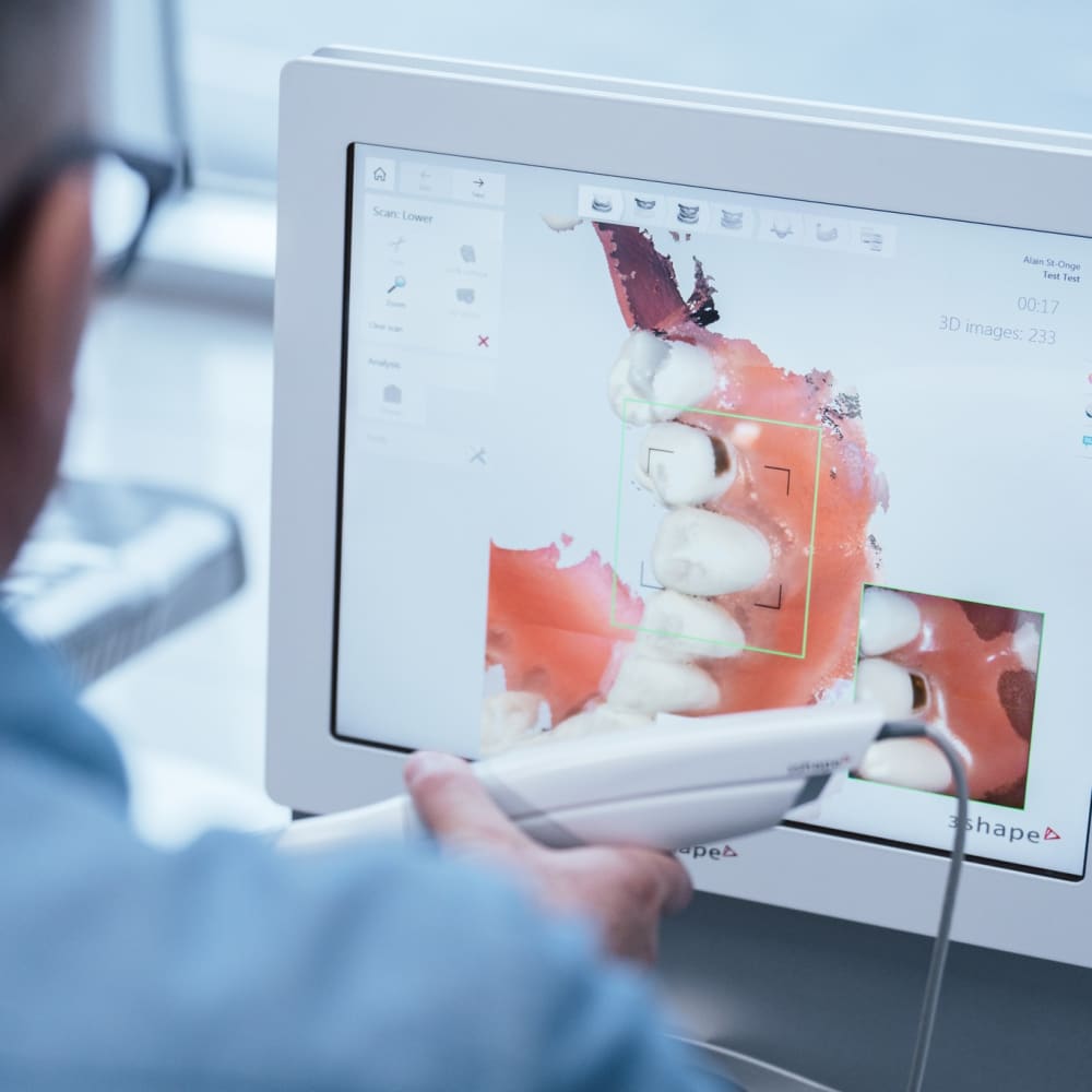 Implants dentaires à La Prairie